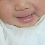赤ちゃんの口