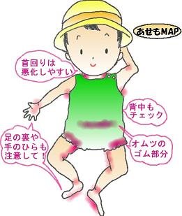 あせもになりやすい場所