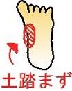 土踏まず